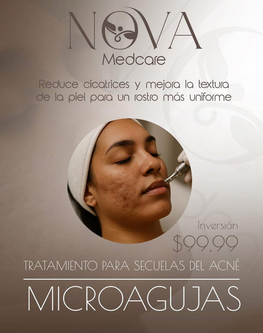 Secuelas de Acné