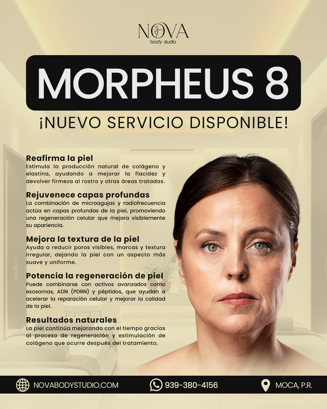 Morpheus 8 Facial
